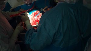 Уникальную операцию по удалению опухоли в мозге размером с мандарин провели врачи в Москве