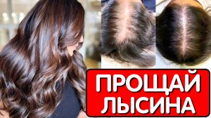 Маска Спасла Многие Шевелюры!! Волосы растут как сумасшедшие и НЕ ВЫПАДАЮТ Блестящие здоровые волосы