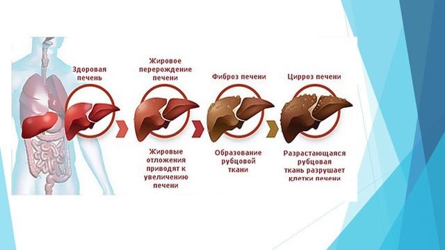 Профилактика токсического гепатита