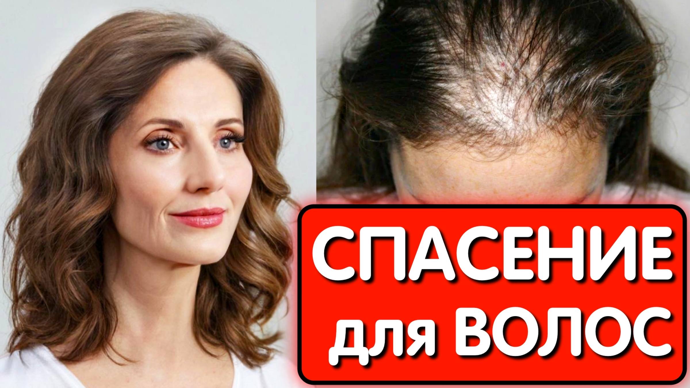 МОЩНЫЙ ОТВАР от ВЫПАДЕНИЯ ВОЛОС РЕЗУЛЬТАТ- Густые и Длинные волосы ОЧЕНЬ БЫСТРО ! смотреть онлайн