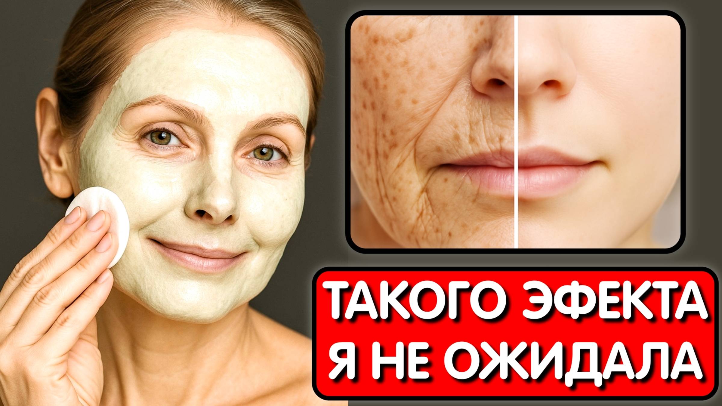 Лучший коллаген устраняет все морщины! Просто нанесите на кожу! Стимуляция коллагена смотреть онлайн