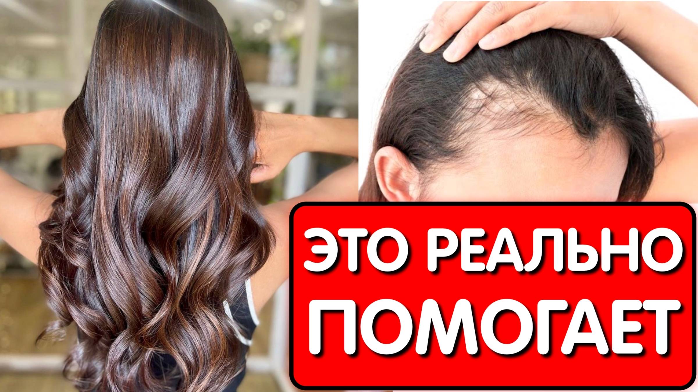 Нанесла это средство и мои волосы растут как сумасшедшие и больше не выпадают! Уже через 1 месяц! смотреть онлайн