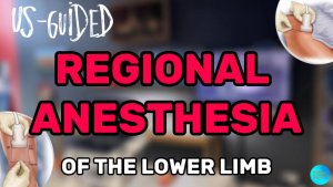РЕГИОНАРНАЯ АНЕСТЕЗИЯ НИЖНЕЙ КОНЕЧНОСТИ ПОД КОНТРОЛЕМ УЛЬТРАЗВУКА #узи #анестезия #узинавигация