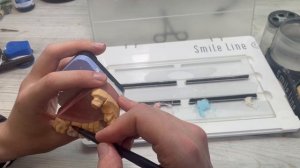 Нанесение металлокерамической дуги из 3х секций