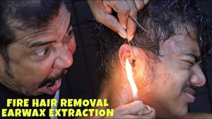 Unwanted Hair Removal by Fire ｜ Earwax Extraction & Ear Fingering by Asim Barber ｜ Head Massage ASMR