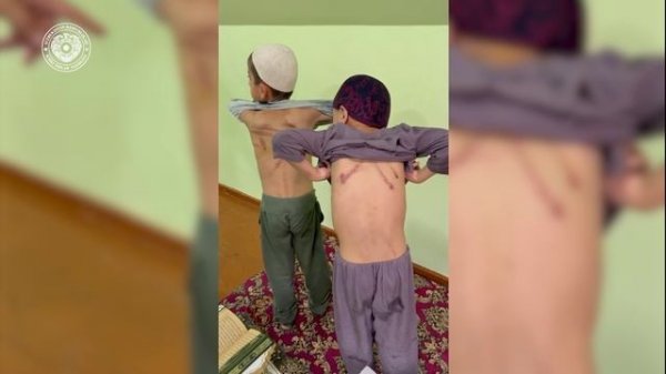 ИИВ ва ДХХ томонидан ҳужра ташкил этиб, болаларга азоб бератганлар аниқланди