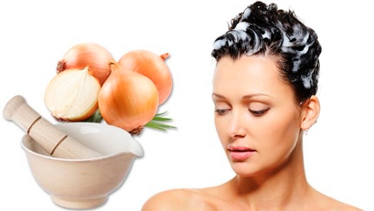 Ваши волосы будут расти в 5 раз быстрее! Быстро избавиться от ВЫПАДЕНИЯ ВОЛОС в домашних условиях смотреть онлайн