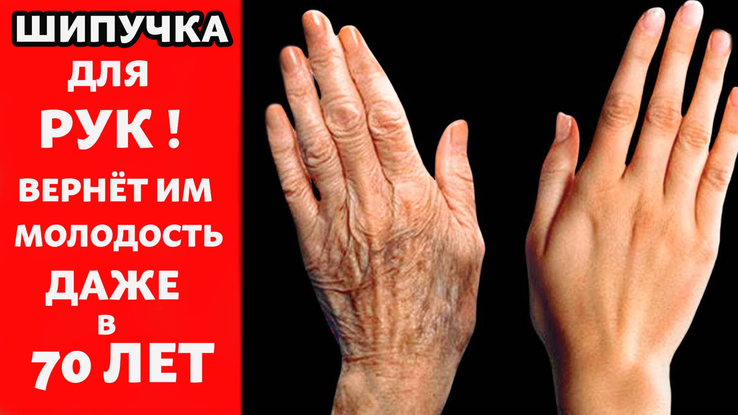 ШИПУЧКА ДЛЯ РУК Потрясающий способ омолодить руки за 2 минуты! Даже если вам 70 лет ! смотреть онлайн