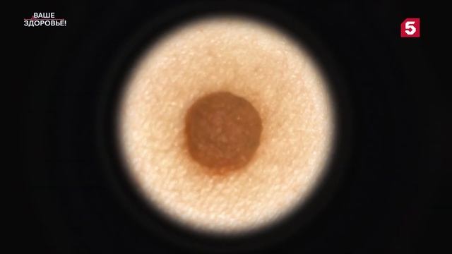 Ваше здоровье | №31 смотреть онлайн