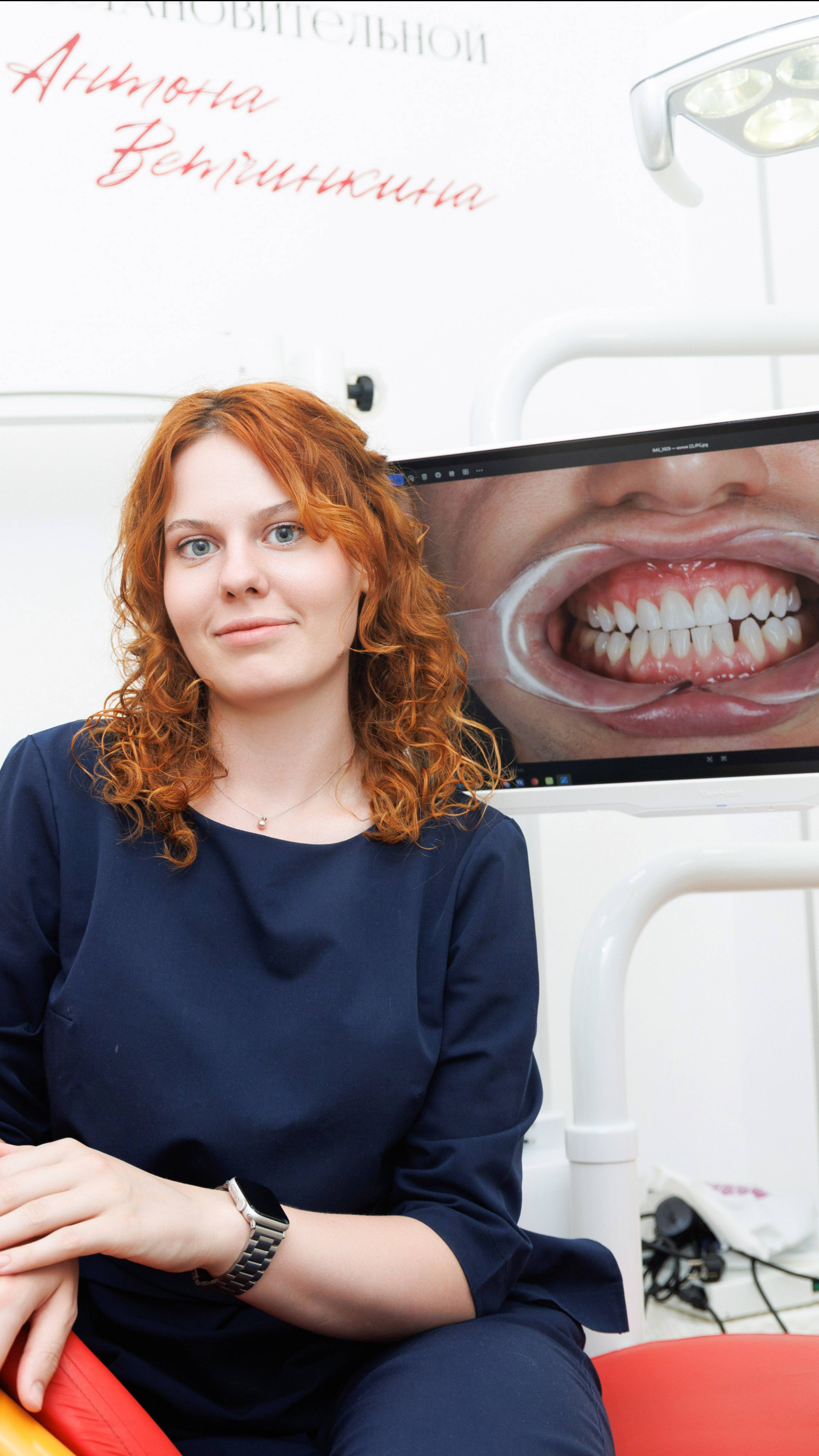 То, что вы не знаете об отбеливание зубов смотреть онлайн