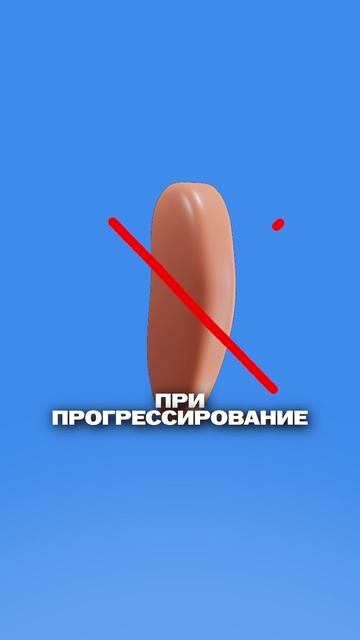Как понять, что у тебя Болезнь Меньера? смотреть онлайн
