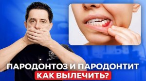 Парадонтит или Парадонтоз? В чём разница и как защитить зубы?