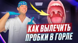 Белые пробки в ГОРЛЕ. Тонзиллит и лечение пробок в гландах.