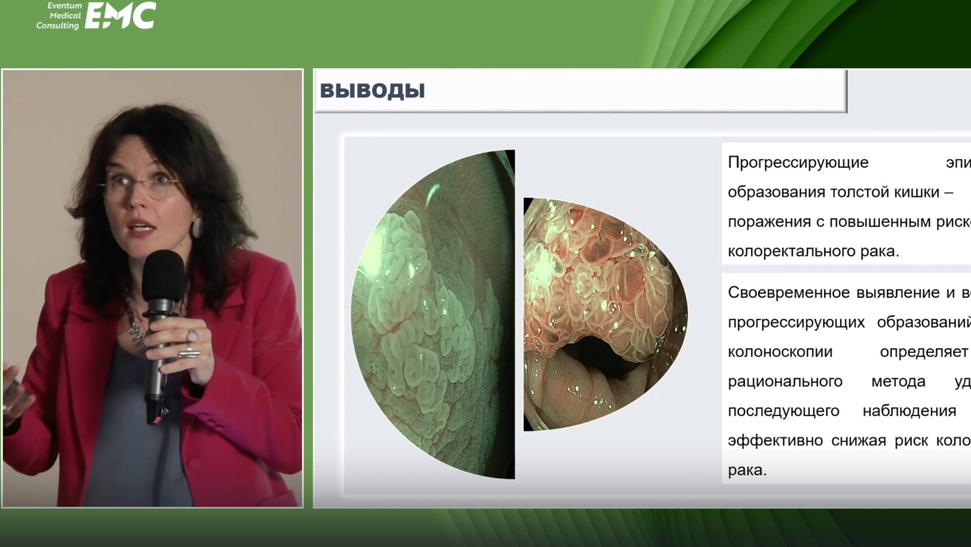 3Агейкина НВ Зубчатые образования кишки перед злокачественным перерождением - диагностика и тактика