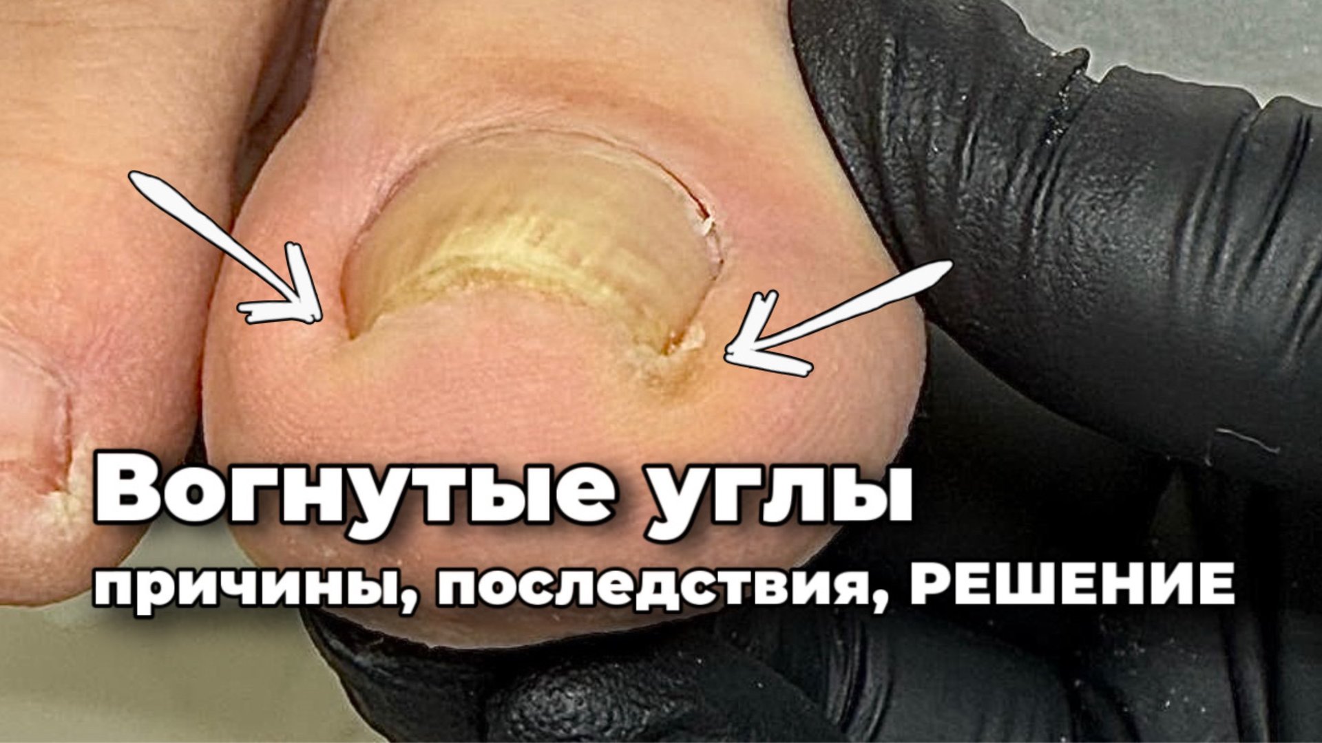 Монолит боковой стенки дал сбой смотреть онлайн