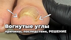 Монолит боковой стенки дал сбой