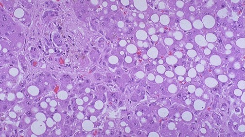 Дистрофии [2 части] смотреть онлайн