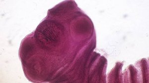 Свиной цепень – опасный паразит внутри нас! Всё, что нужно знать