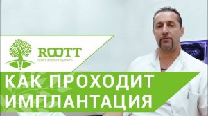 Установка импланта зуба. Этапы  установки импланта зуба. ROOTT