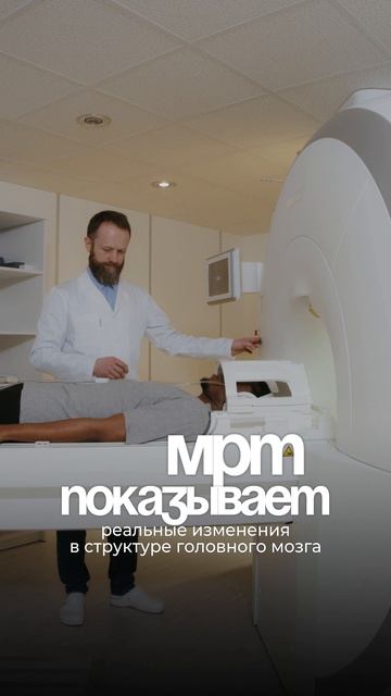 Туман в голове после ковида – не выдумка. Это реальное повреждение мозга.