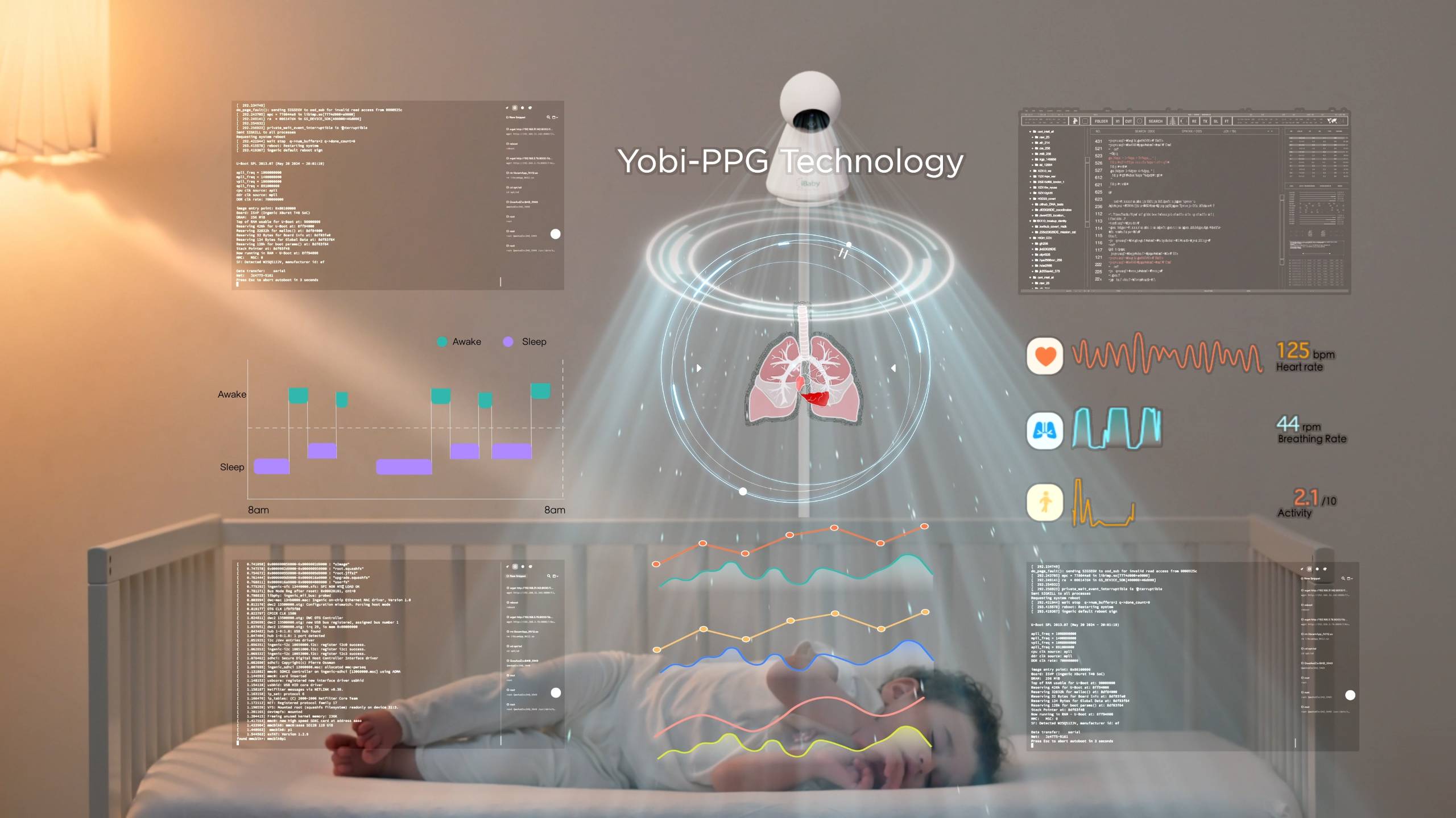 IBaby Yobi I20 - How It Works