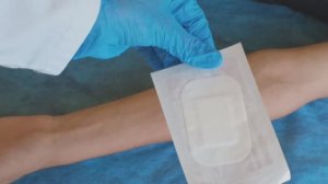 Приенение повязки стерильной адгезивной