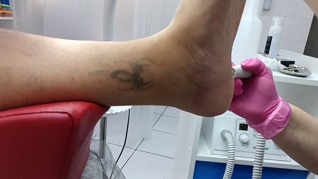 Педикюр для мужчины