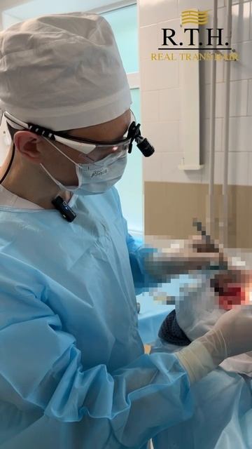 Deep Plane Facelift: глубокая плоскостная подтяжка лица смотреть онлайн