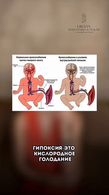 Что происходит с малышом при тонусе матки? смотреть онлайн