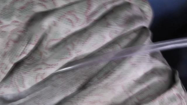 зарыбление пруда белым амуром