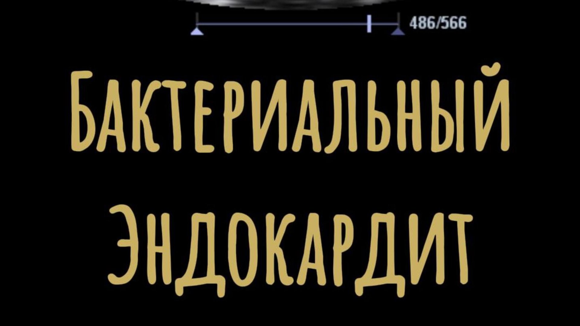 БАКТЕРИАЛЬНЫЙ ЭНДОКАРДИТ. ВЕГЕТАЦИИ НА МИТРАЛЬНОМ И АОРТАЛЬНОМ КЛАПАНАХ #узи #сердце #эхокг