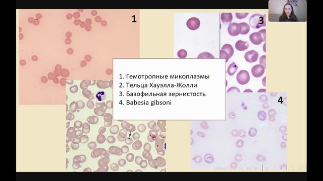 Упоротый Подкаст - Ксения Таскина: гемоплазмы, гемобартонеллы и бартонеллы.