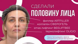 Сравни половинки лица! Комплекс anti-age за 1 визит!