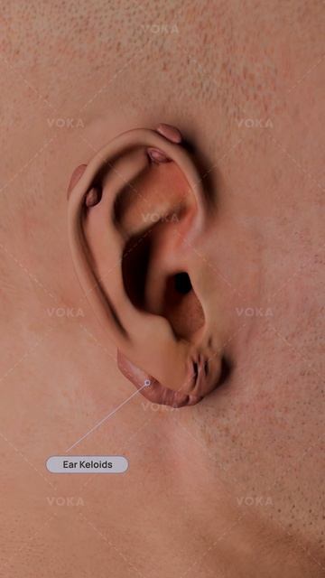 VOKA 3D Anatomy & Pathology | Rus