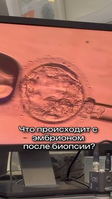 Центр Репродукции Человека и ЭКО