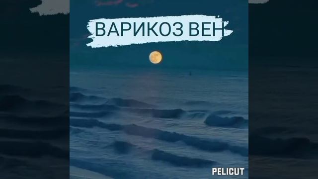 Лечение Варикоза вен