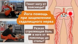 Болит нога от поясницы? Сидеть больно, ходить тяжело?  Йога-помощь при защемлении седалищного нерва