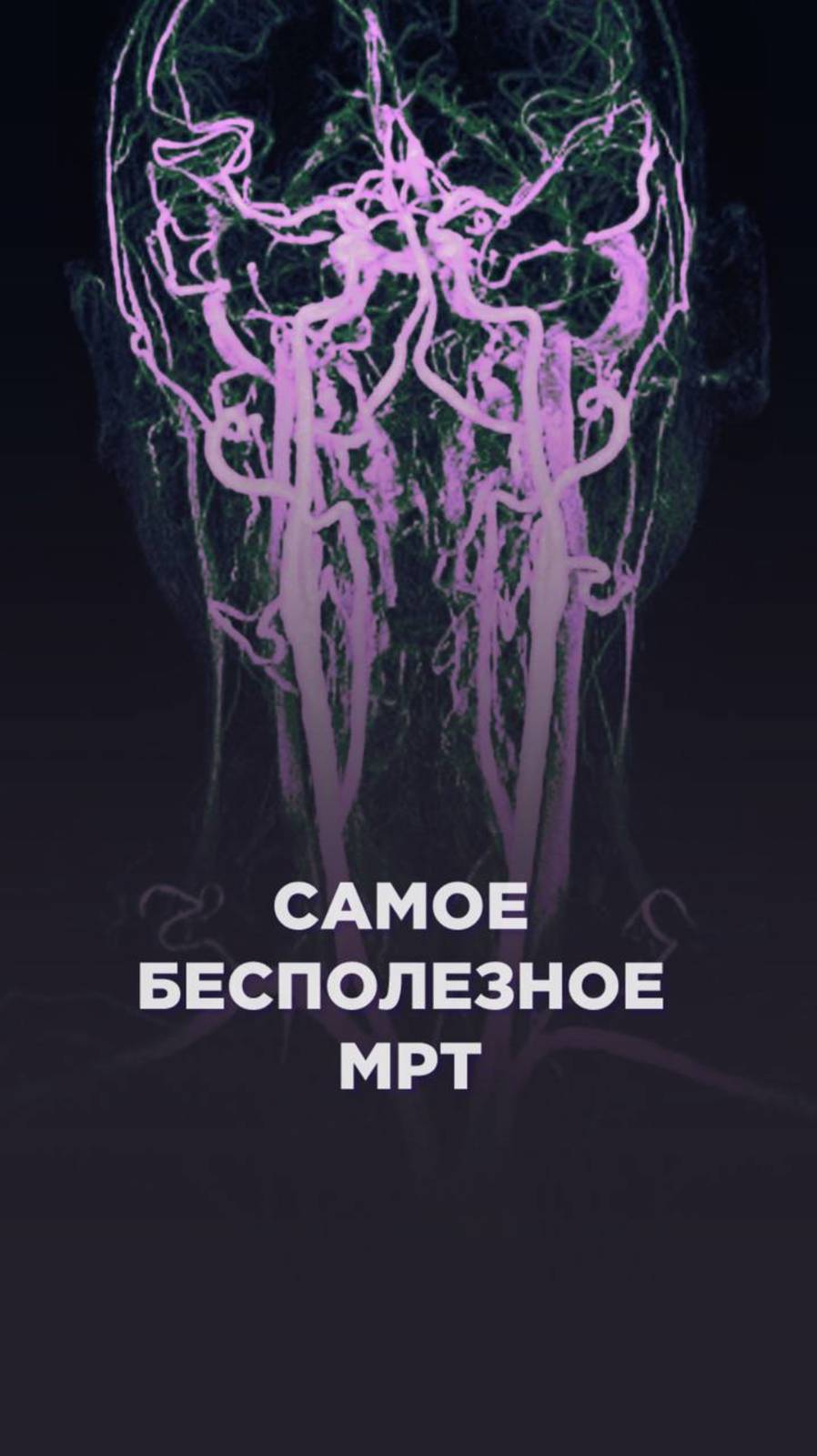 ⛔️ Не спешите делать МРТ — зря потратите деньги!