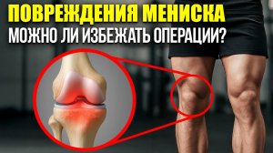 🔥 Консервативное лечение повреждения мениска – можно ли избежать операции?