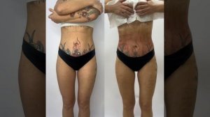 6 сеансов -4кг