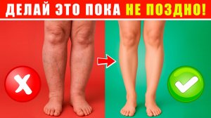 СЕКРЕТ ЛЕГКИХ НОГ! | Сосудистая гимнастика от ОТЕКОВ и УСТАЛОСТИ!