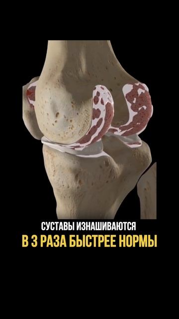 Пиши слово «Стопа» в комментариях и я пришлю авторское упражнение смотреть онлайн