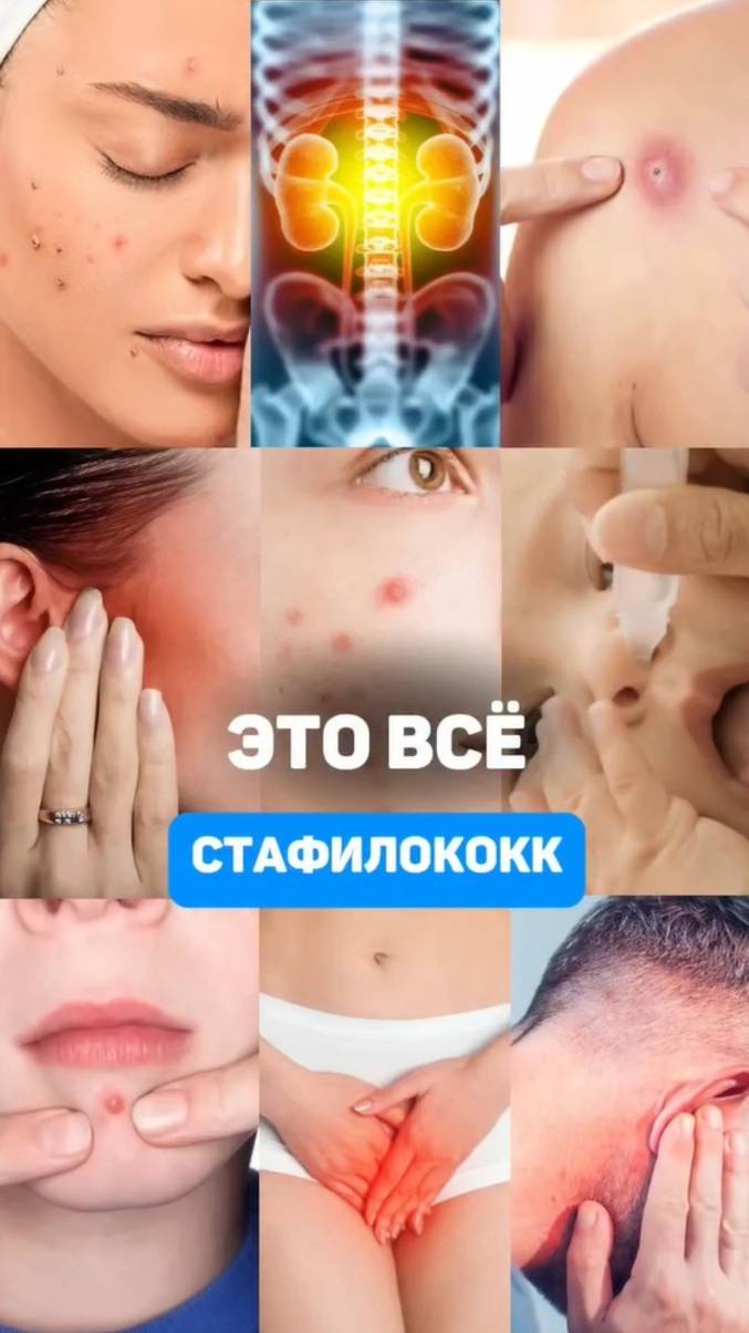 Причина этих болезней - стафилококк смотреть онлайн