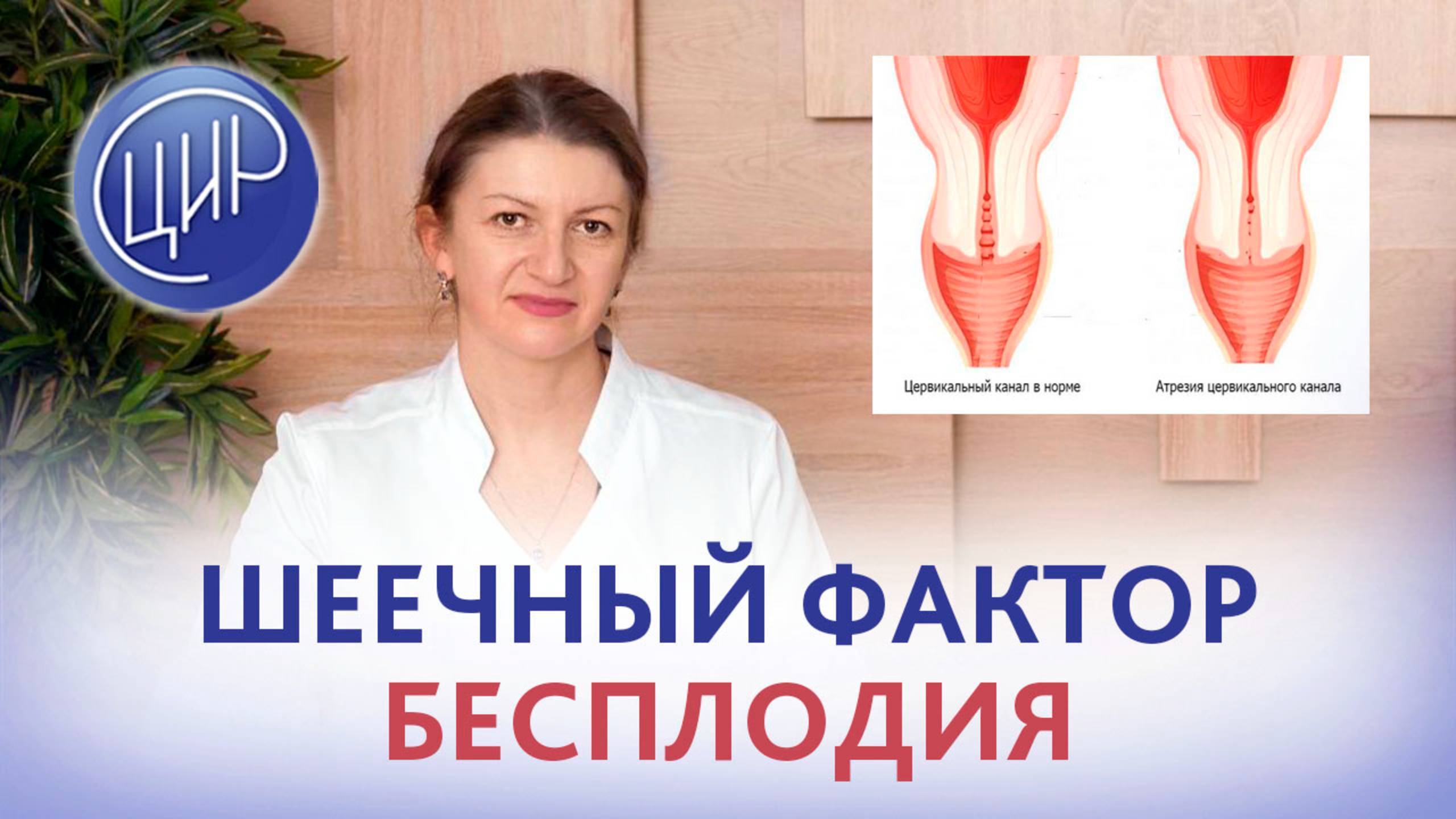 Маточный фактор бесплодия - что это такое, шеечный фактор бесплодия. Атрезия цервикального канала. смотреть онлайн