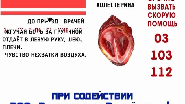 Здоровое Забайкалье инфаркт смотреть онлайн