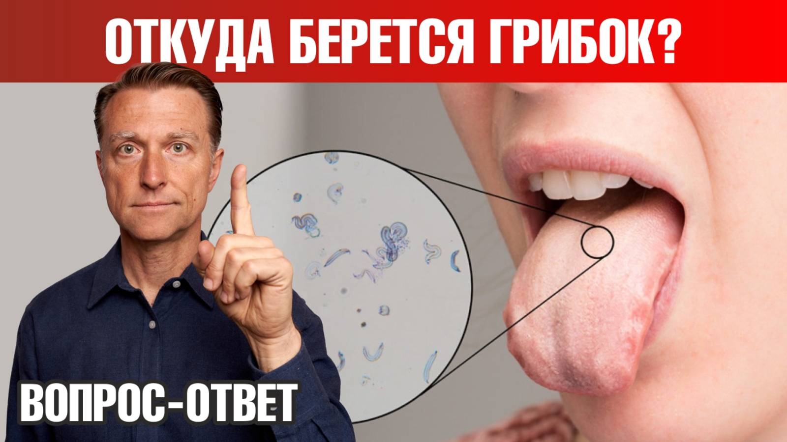 Кандида? Грибок ногтя на ноге или на коже головы 👉 реальные причины