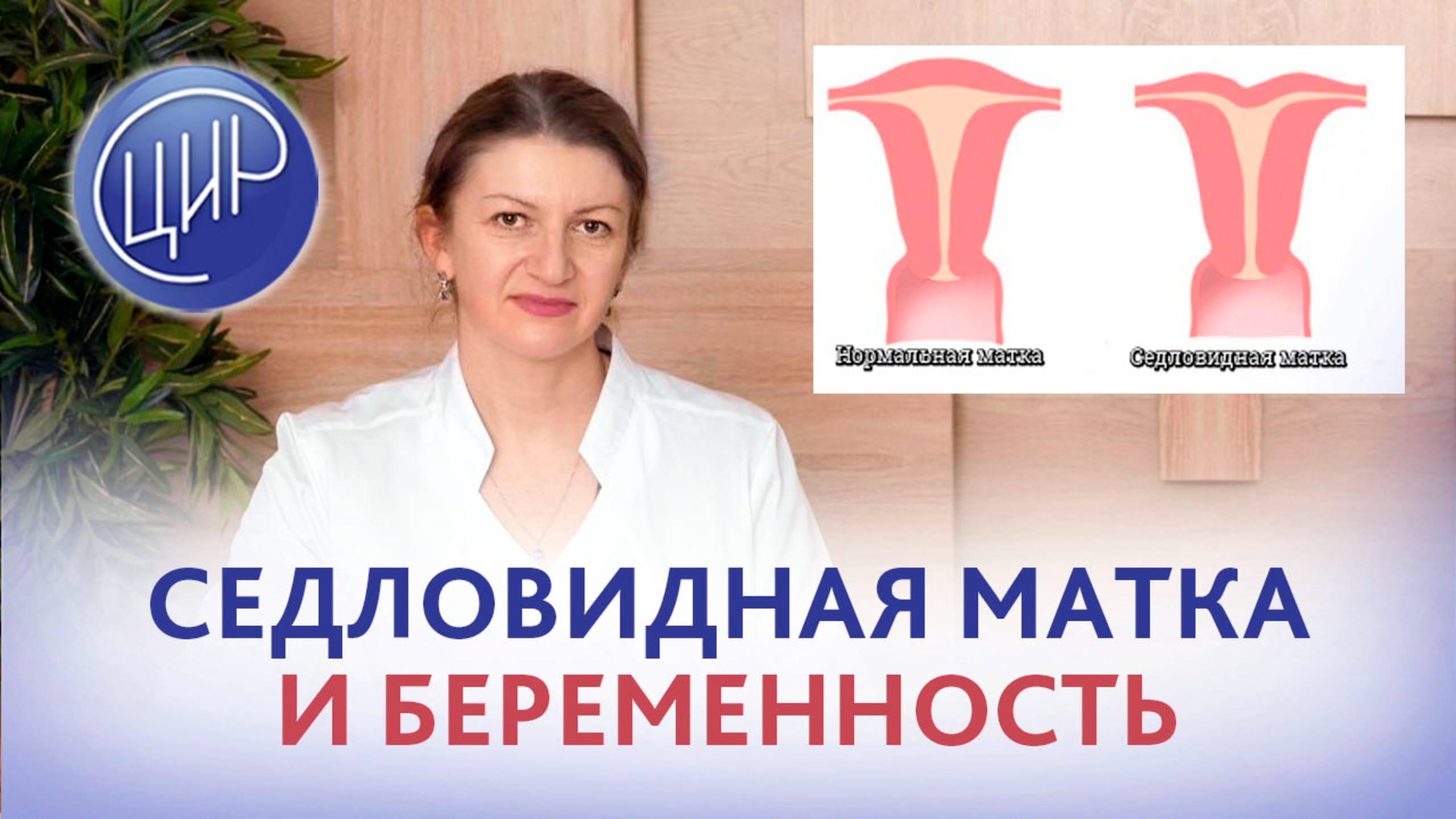 Седловидная матка: причины развития аномалии и влияние на наступление и невынашивание беременности. смотреть онлайн
