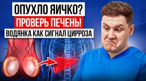 ВОДЯНКА ЯИЧКА: А ЕСЛИ ВИНОВАТА ПЕЧЕНЬ? КАК ЦИРРОЗ ВЫЗЫВАЕТ ГИДРОЦЕЛЕ.