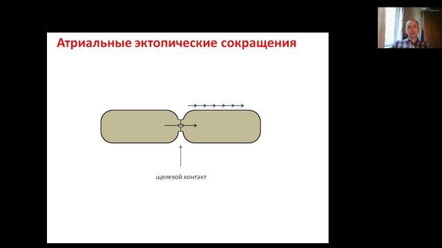Аритмия. Часть 2. Наджелудочковые аритмии.