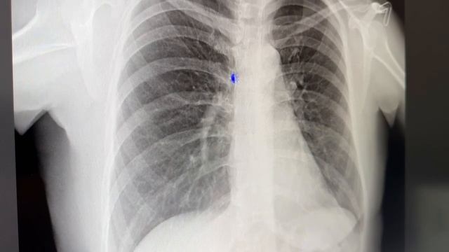 Врач-рентгенолог медицинского центра АГУ смотреть онлайн